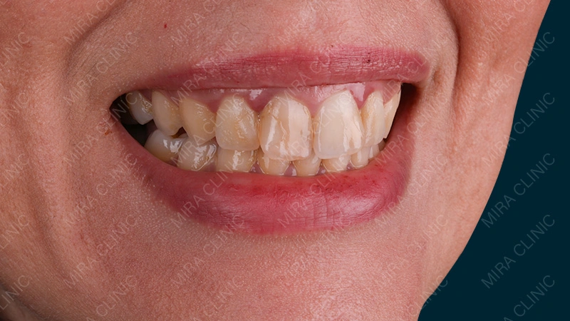 Hollywood experience Istanbul